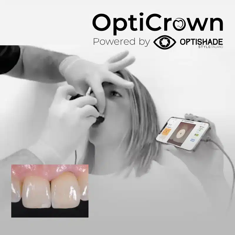 Webinaire OPTISHADE OptiCrown