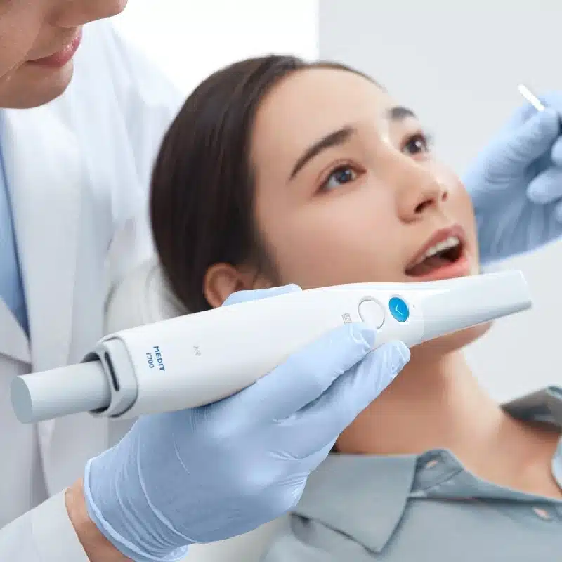 Qu'est-ce qu'un scanner intraoral ?