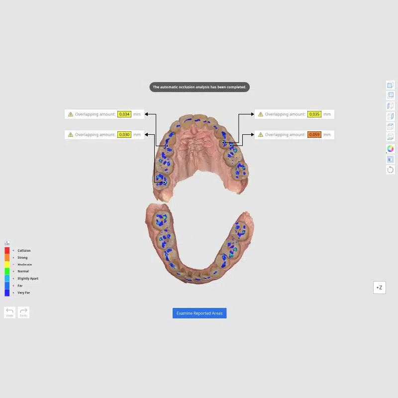 Medit Occlusion Analyzer