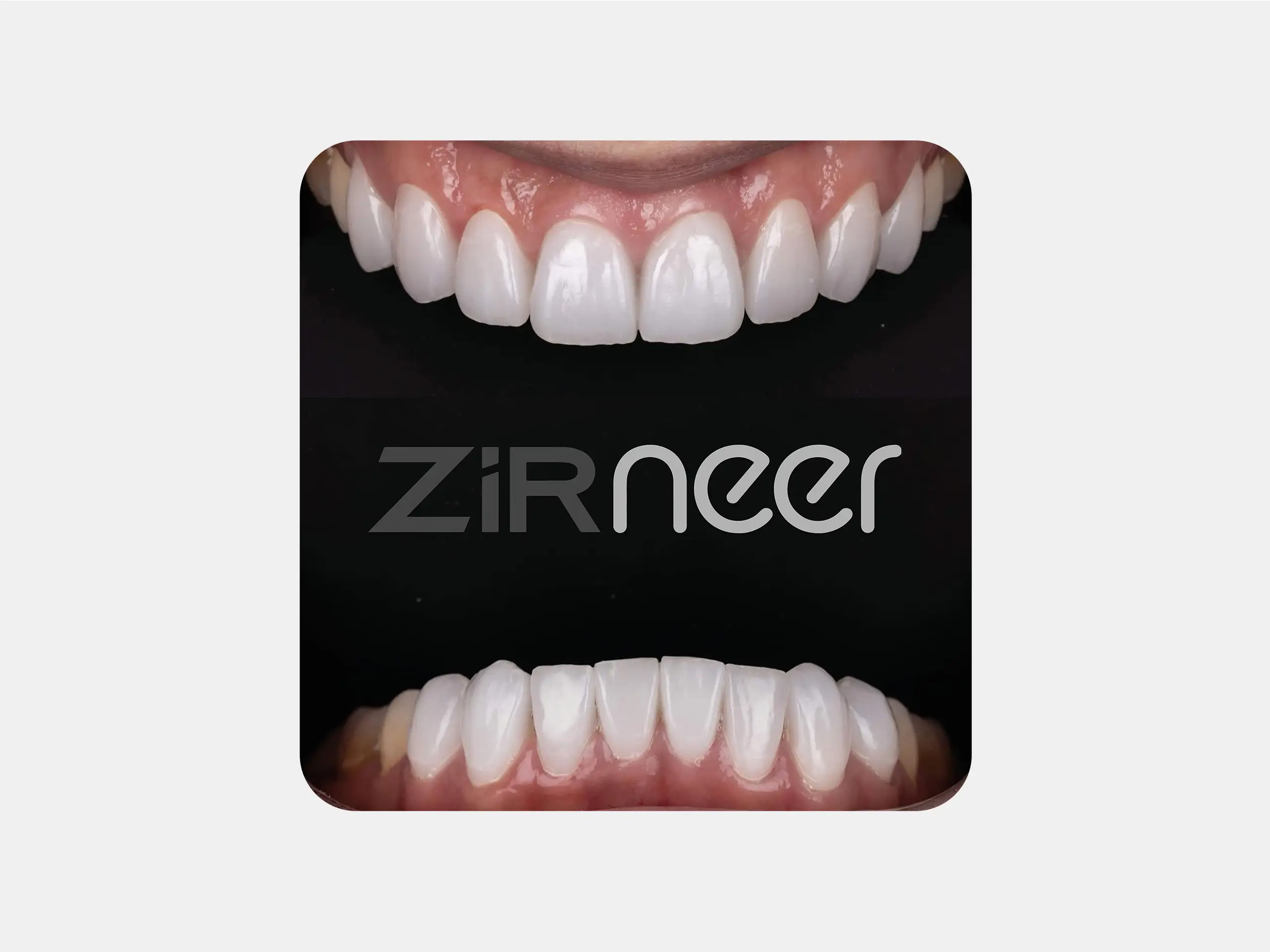 ZirNEER