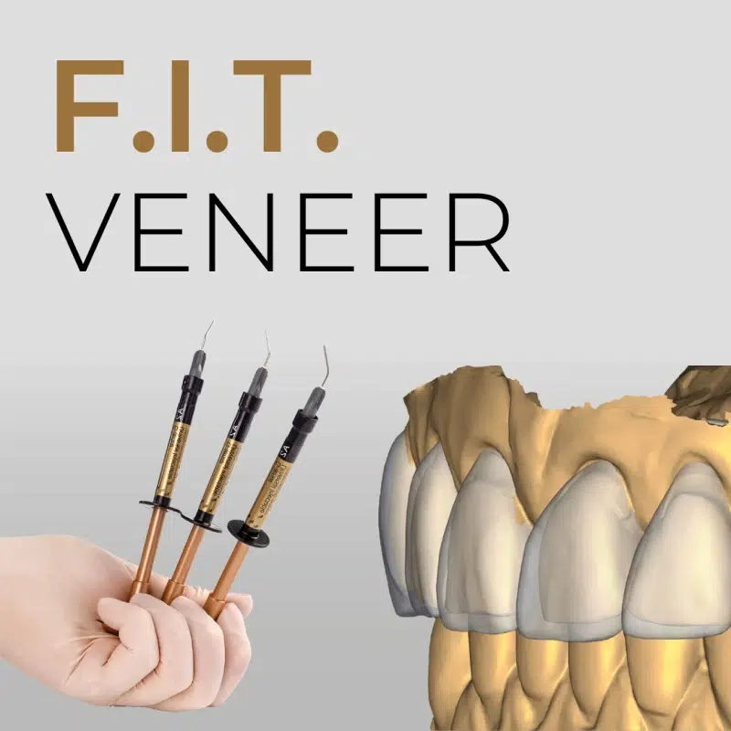 F.I.T. VENEER