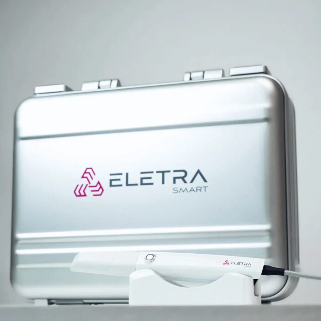 Pourquoi ELETRA SMART ?