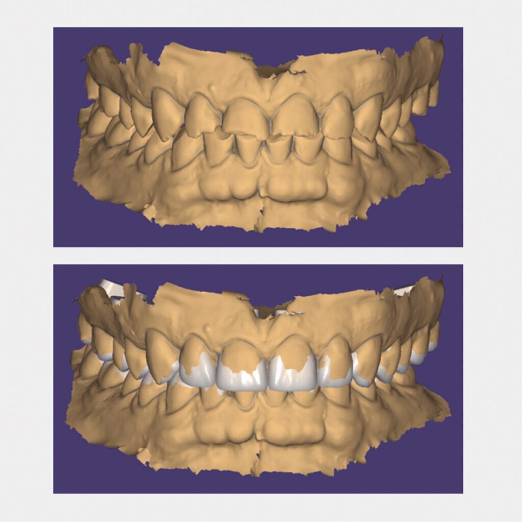 set up 1600px fit (4)-min