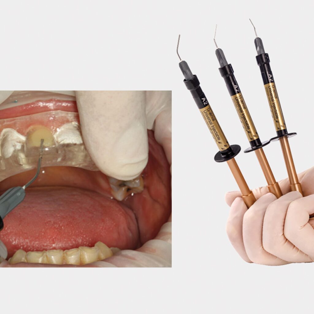 set up 1600px fit (6)-min