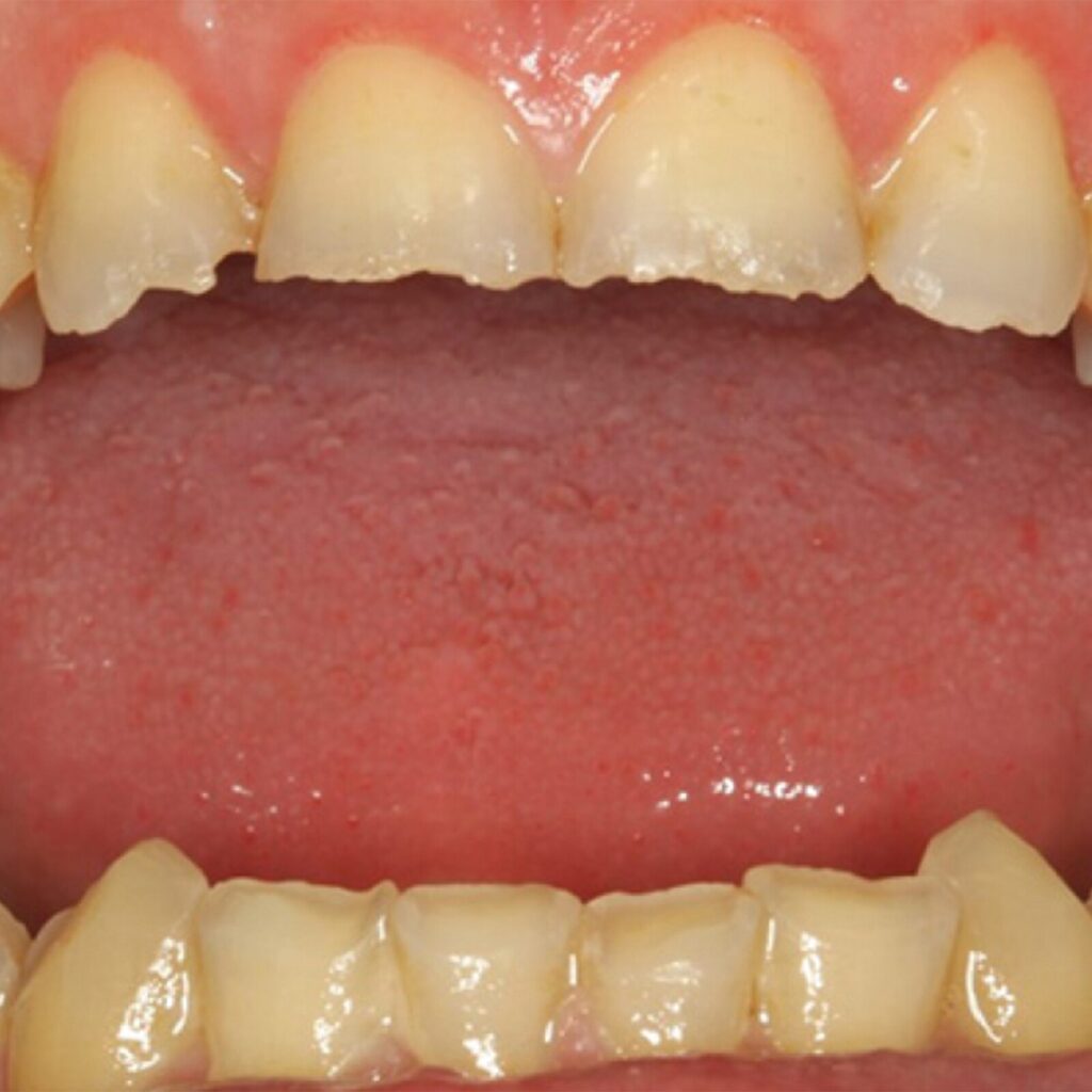 set up 1600px fit (7)-min