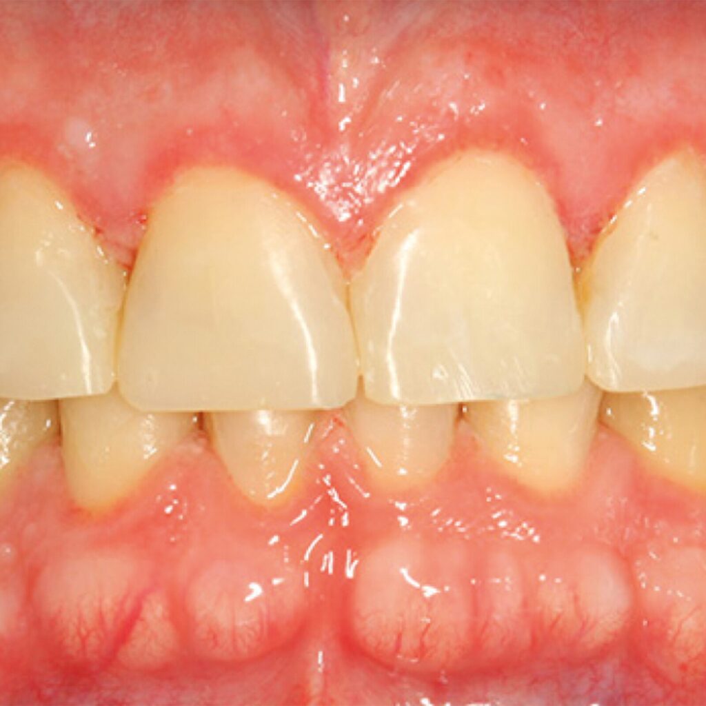 set up 1600px fit (9)-min