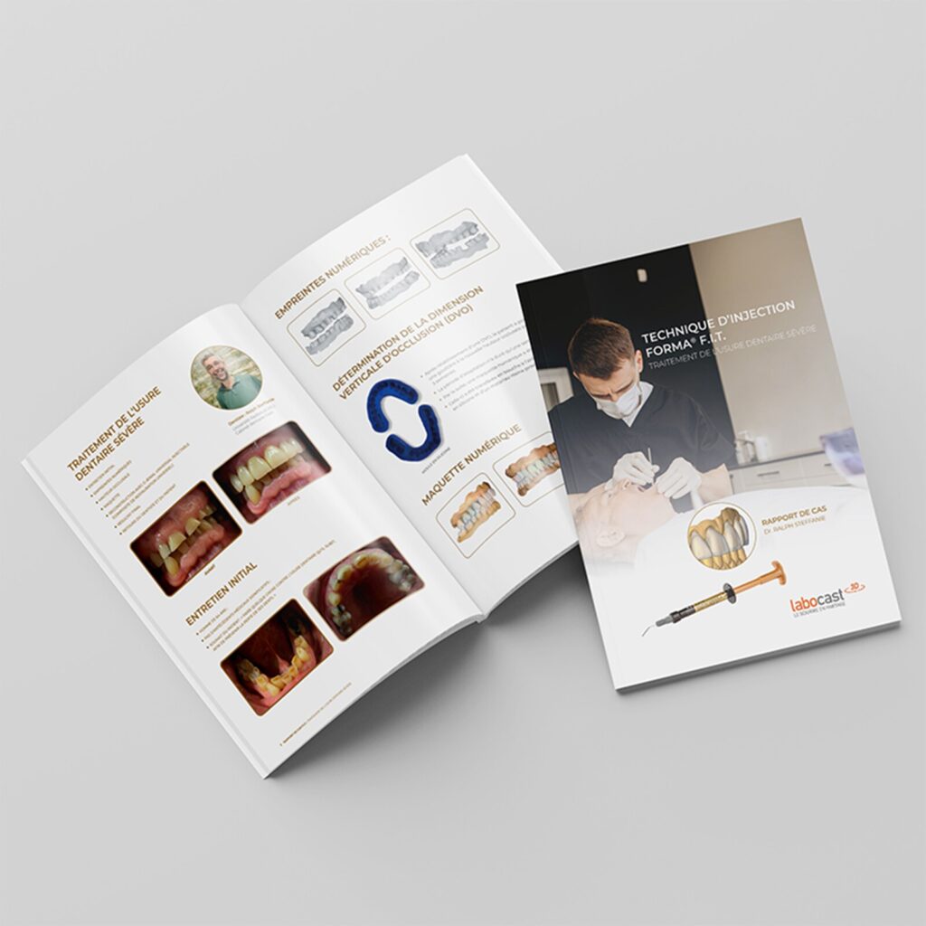 Comment traitez-vous les patients souffrant d'usure dentaire ?