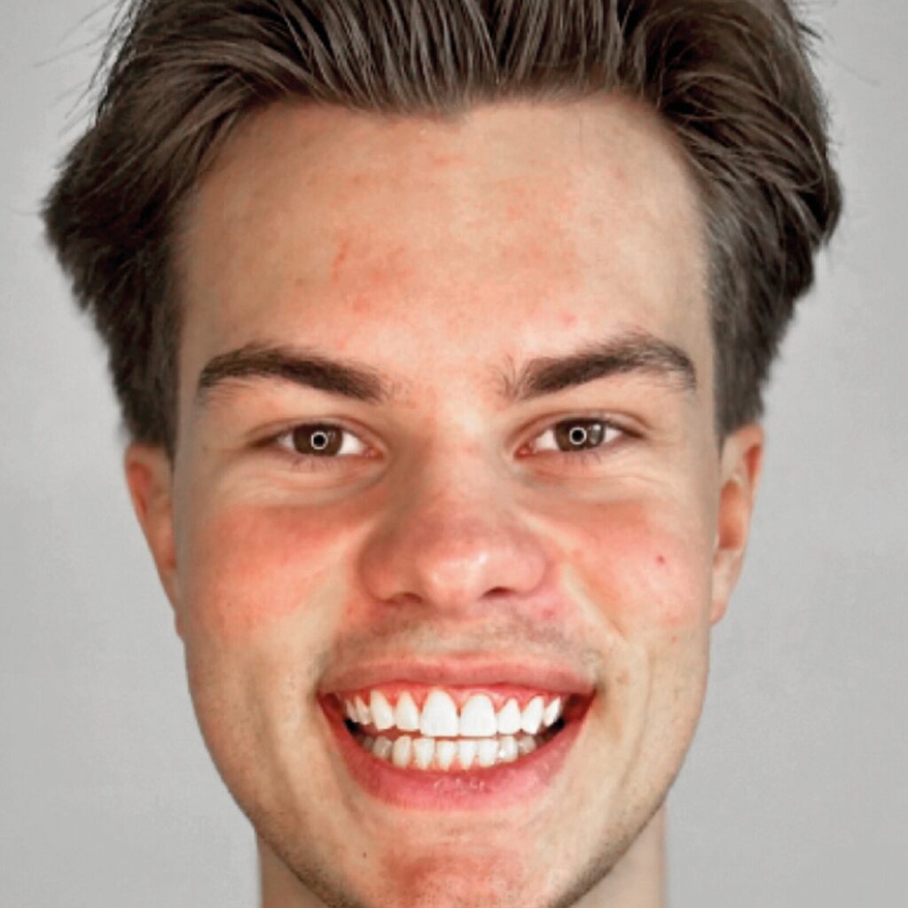 set up 1600px fit veneer (8)-min