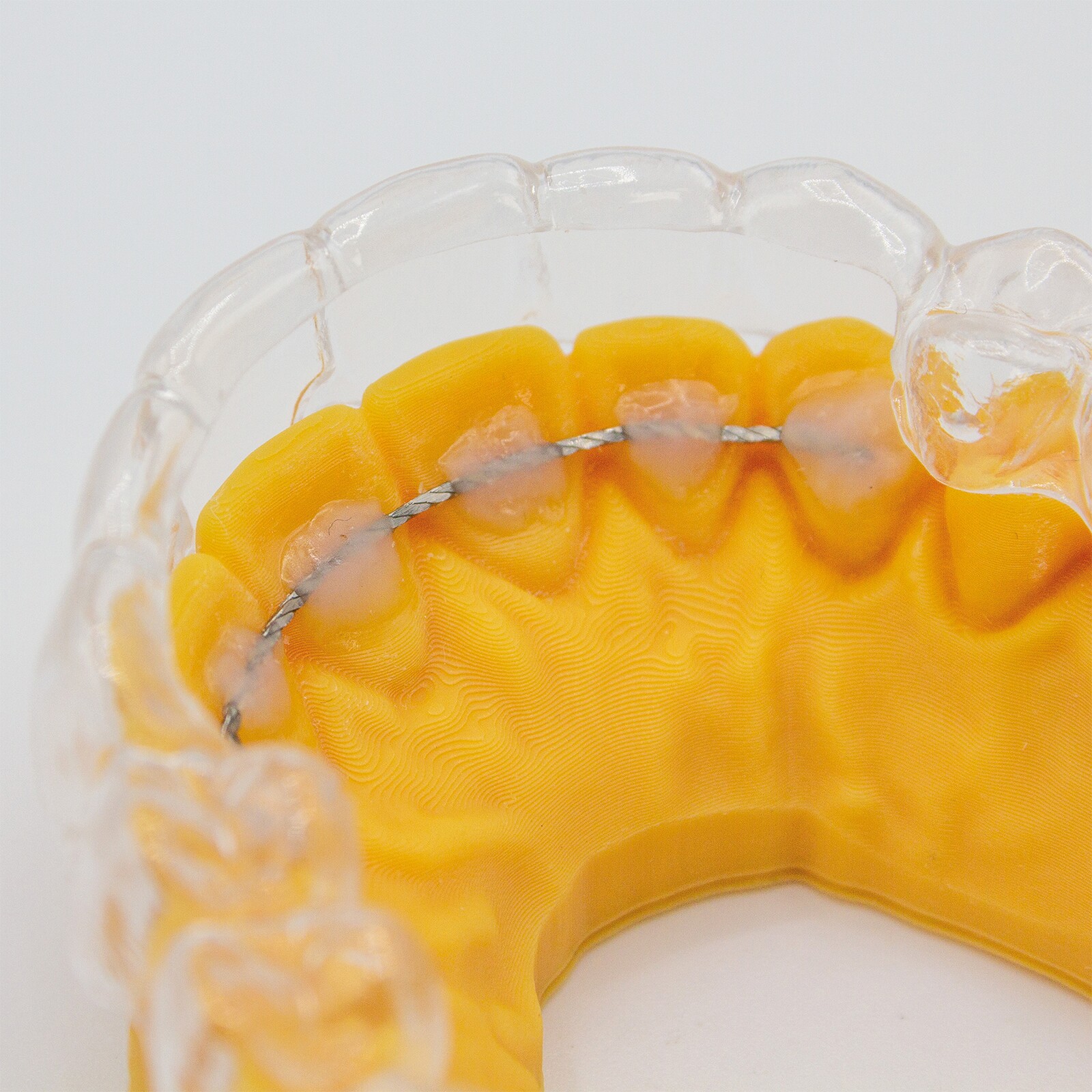 Webinaire - Ecodont Combi Retainer