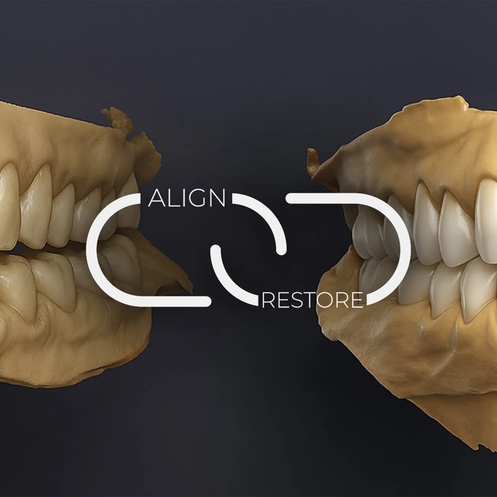 L’intérêt de l’alignement pré-restauratoire