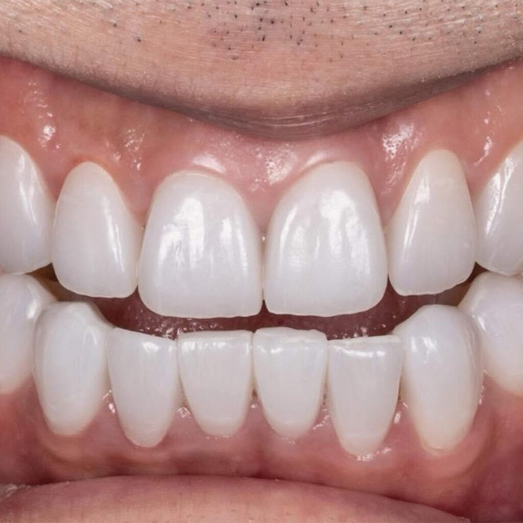 set up 1600px zirneer (2)-min