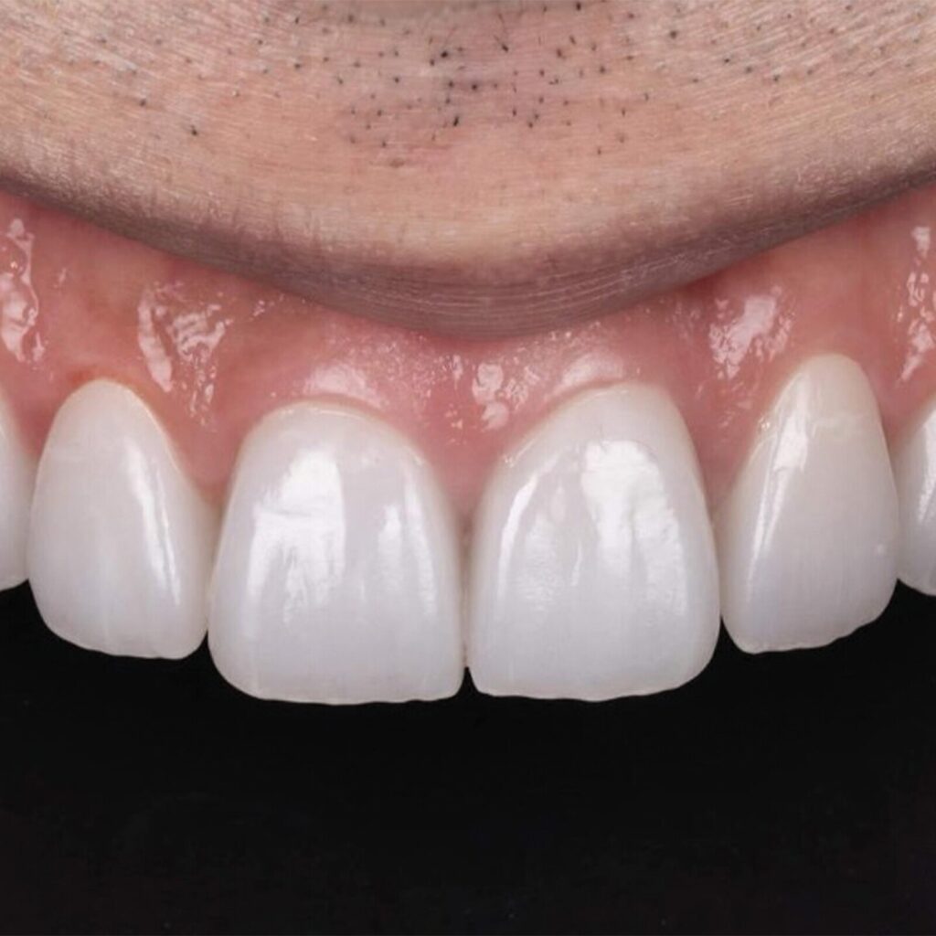 set up 1600px zirneer (3)-min