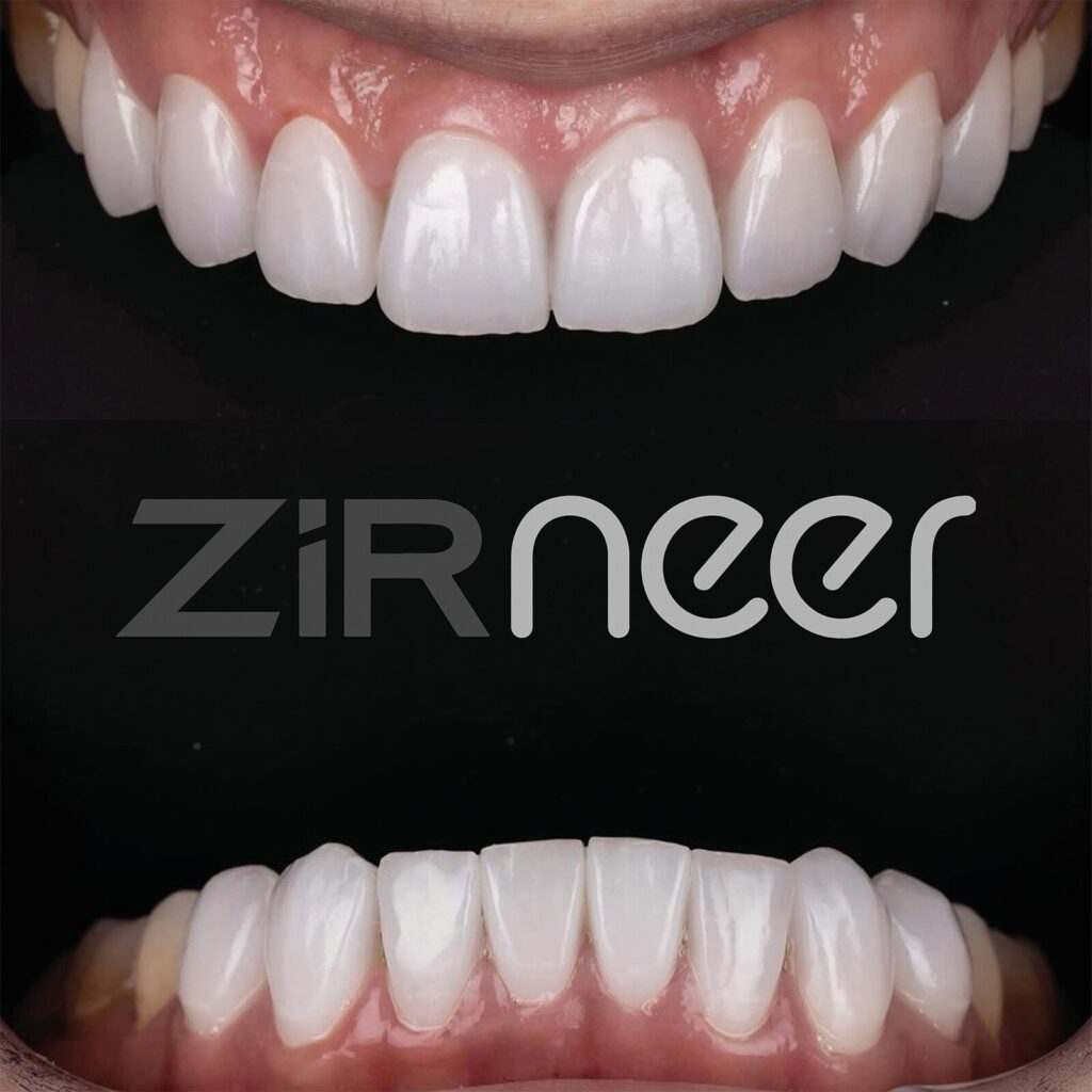 set up 1600px zirneer (5)-min