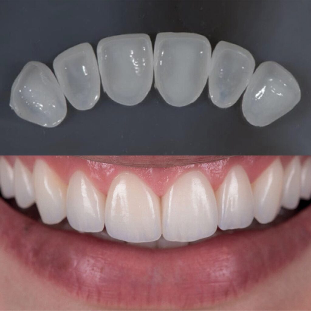 set up 1600px zirneer (7)-min