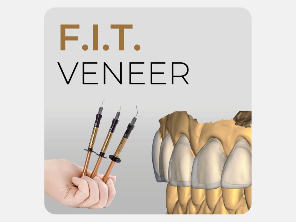 F.I.T. VENEER