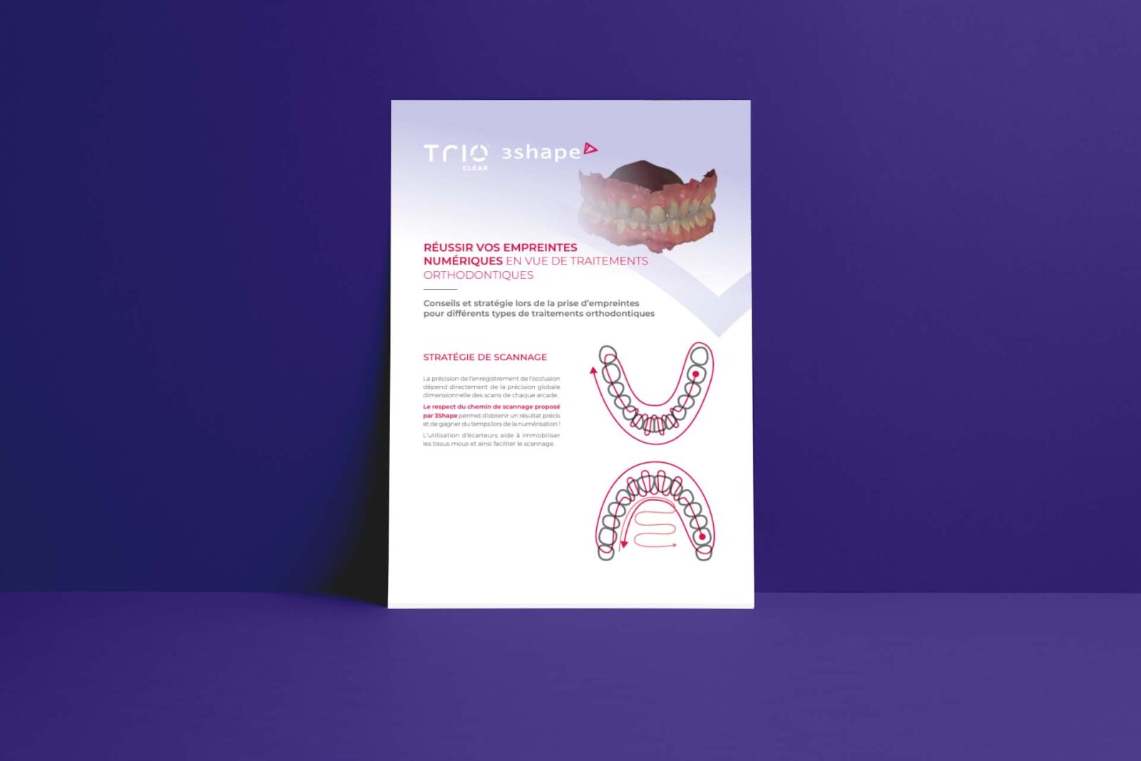 Comment réussir vos empreintes numériques en vue de traitements orthodontiques