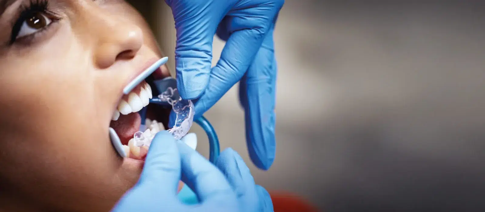 empreinte unique pour un ajustement personnalisé