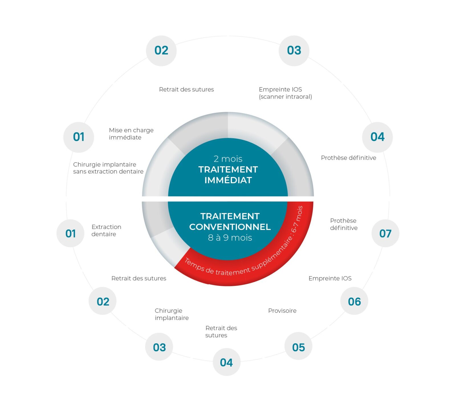 De la planification à la pose : l’efficacité des workflows numériques