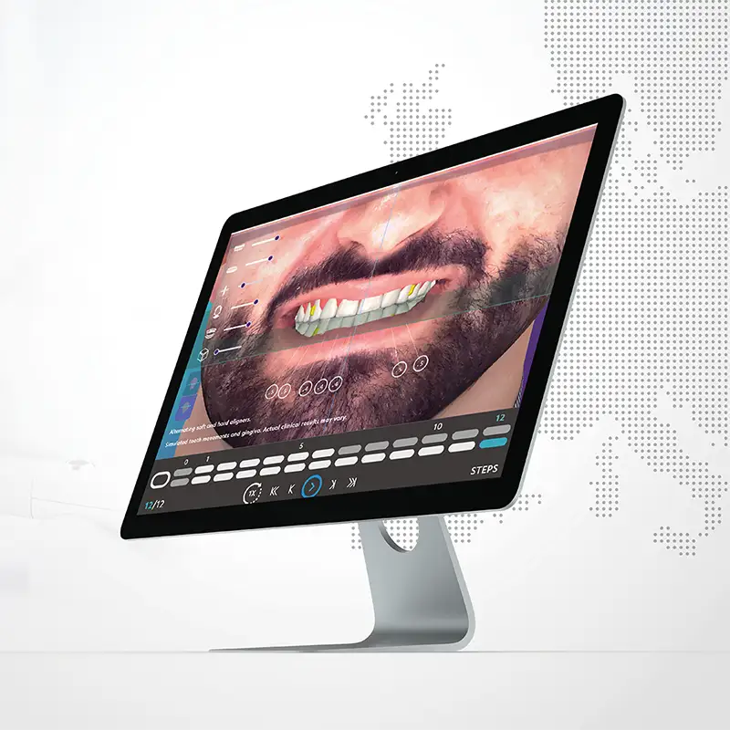 Smile design interface