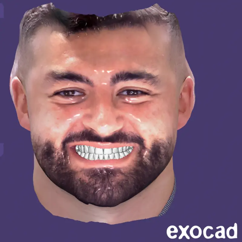 Smile design rendu d'affichage