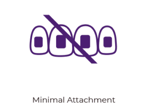 Diminution du nombre de Taquets