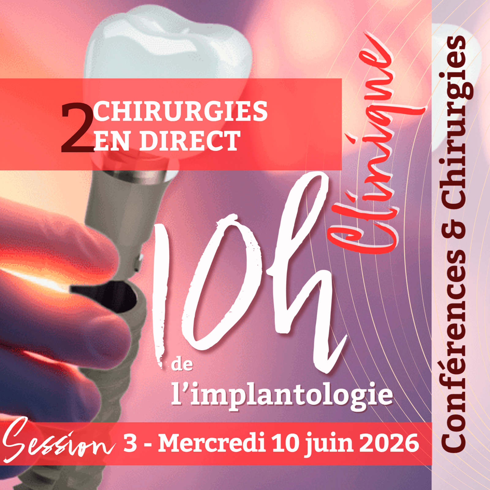 Les 10 heures de l'implanto