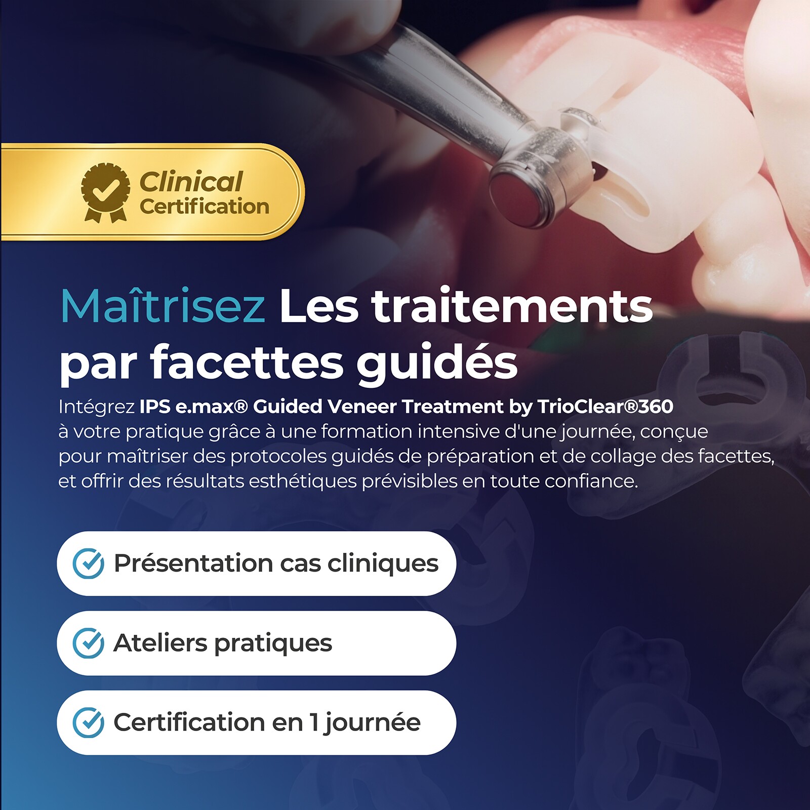 Certification IPS e.max® Guided Veneer by TrioClear® 360