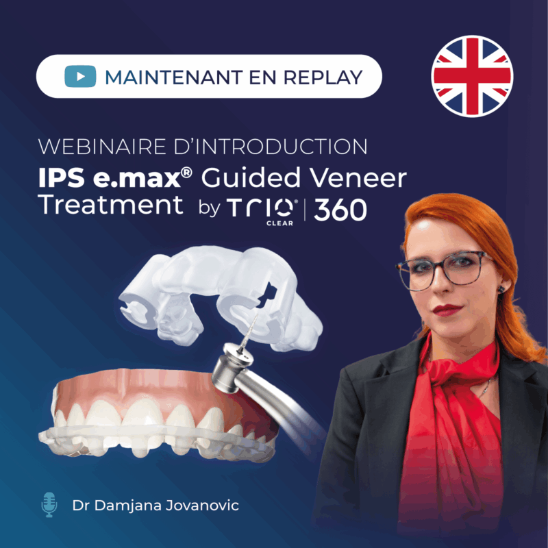 Webinaire - IPS e.max® Guided Veneer Treatment by TrioClear®360