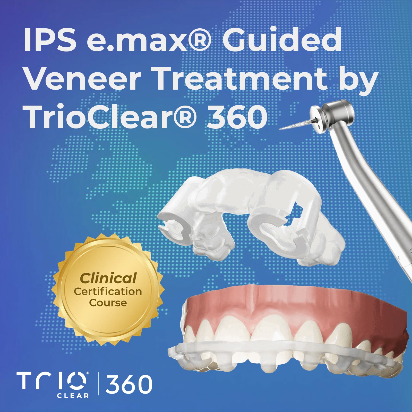 Certification IPS e.max® Guided Veneer by TrioClear® 360