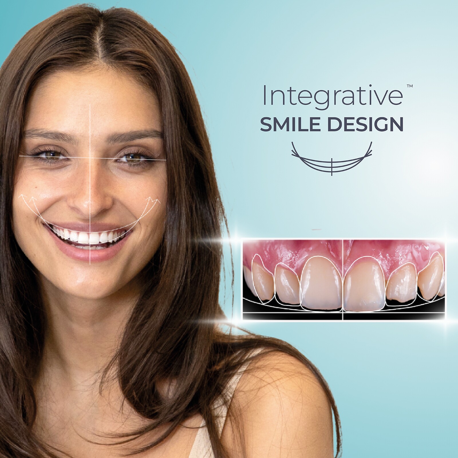 Integrative SMILE DESIGN